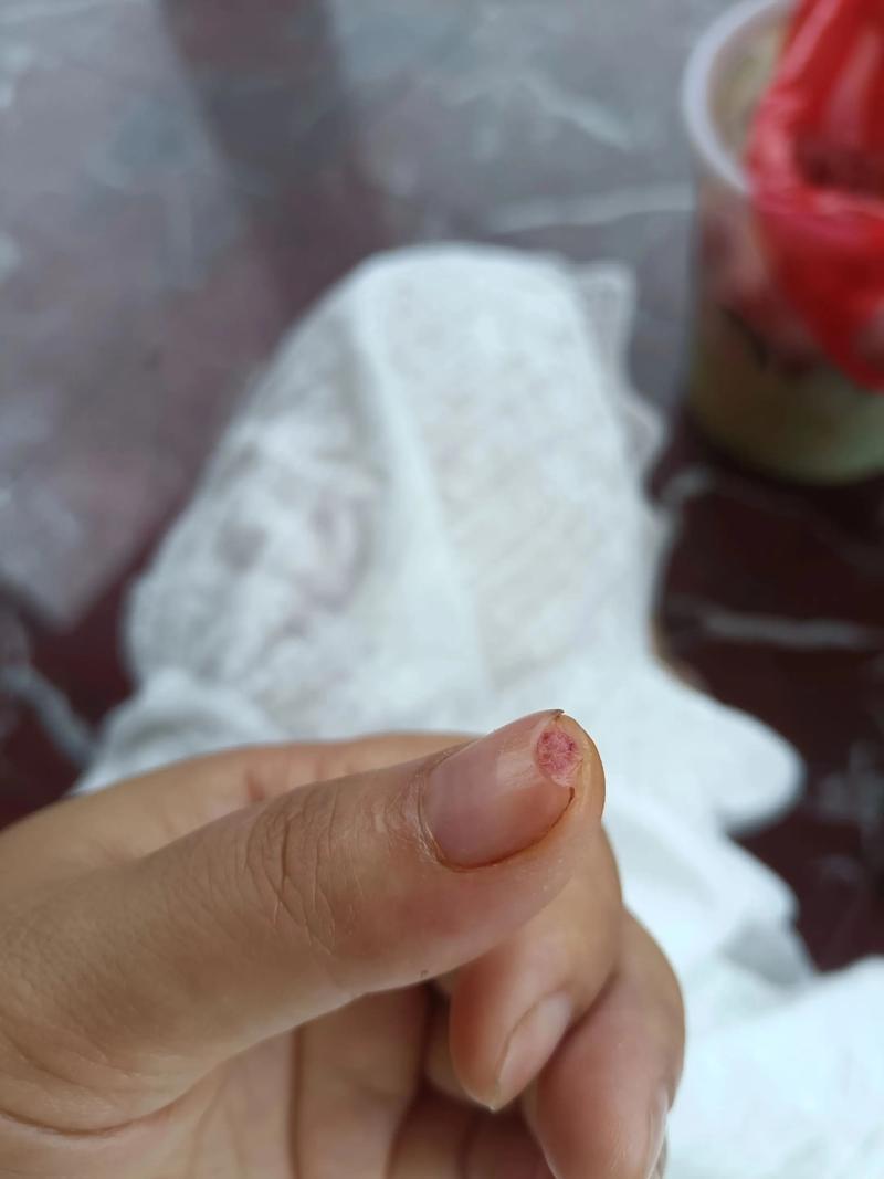 指尖切割