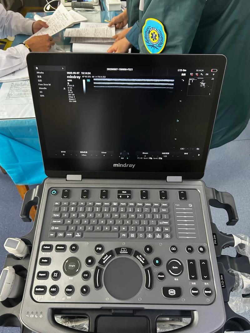 迈瑞便携式超声红包正版