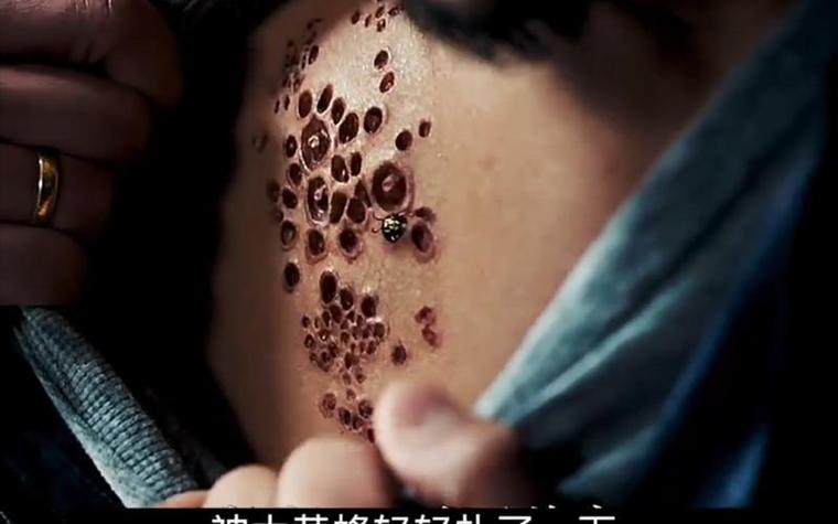恐惧症(Phobies)