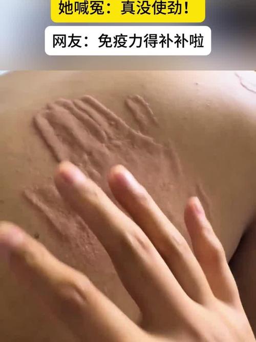 巴掌印PO